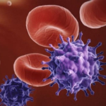 Leucemia, scoperto a Bari test per misurare efficacia terapia